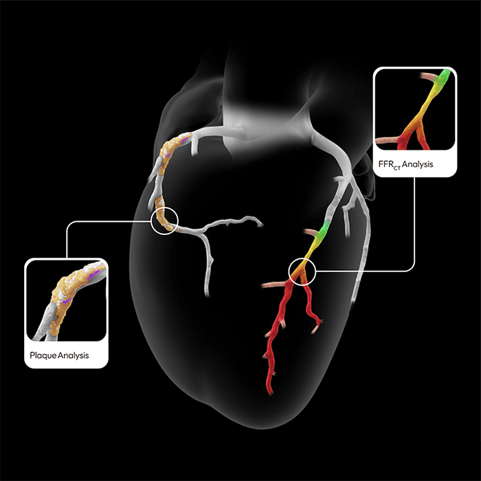 CardioNow Heart Scan