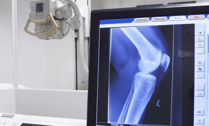 X-ray image in a sports medicine setting