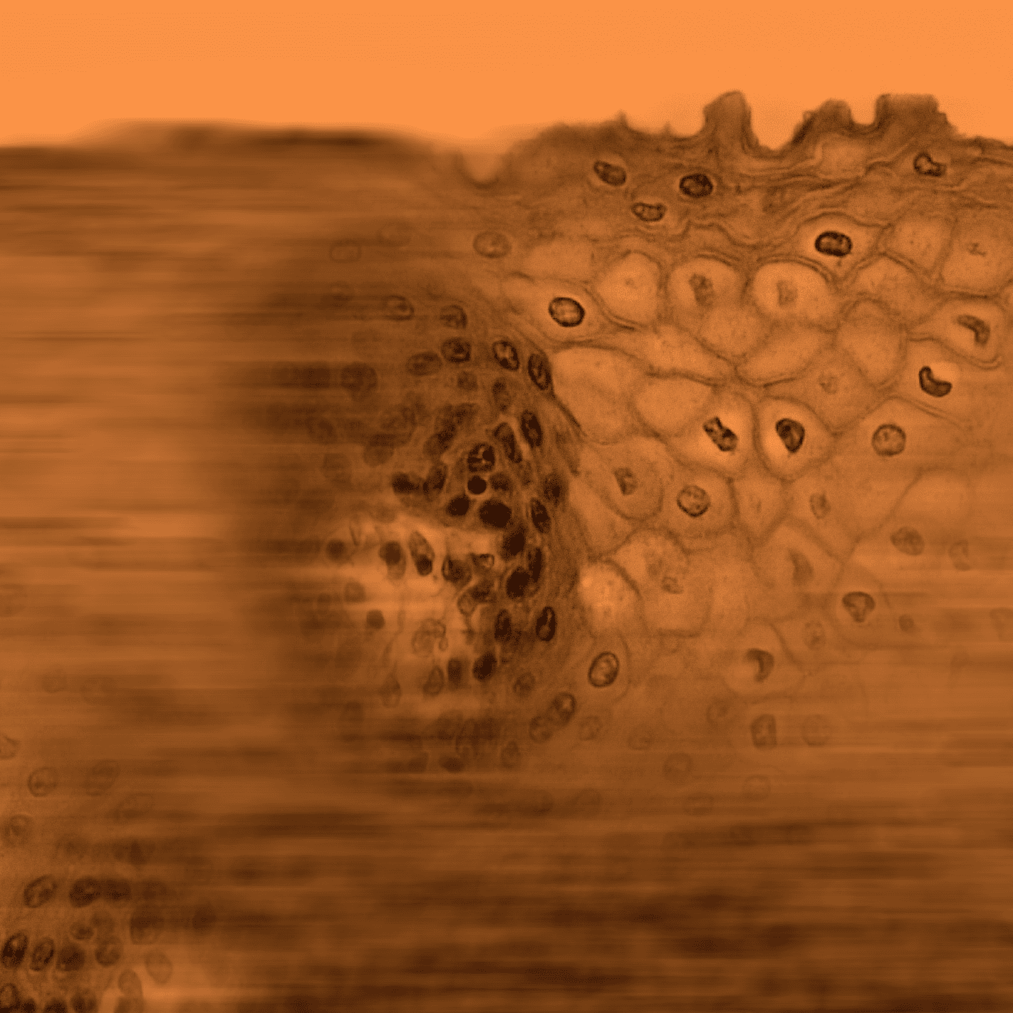 Hair Follicle Stem Cell Banking